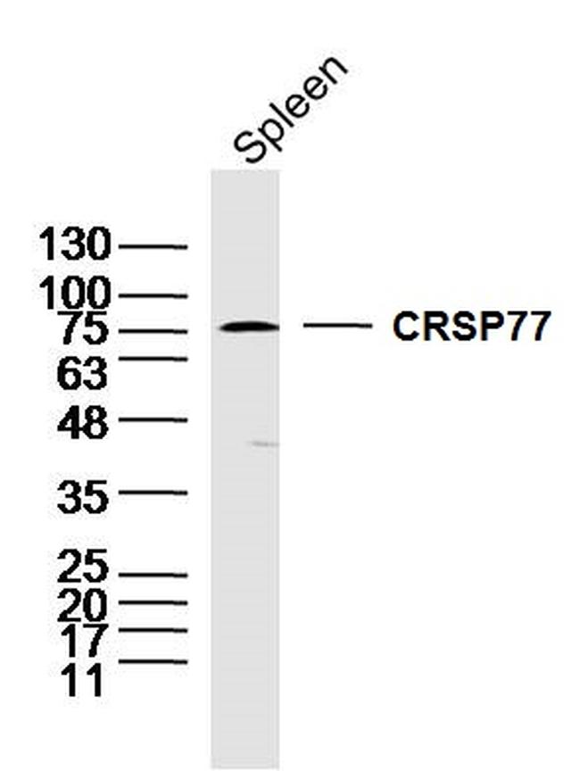 CRSP77 Antibody in Western Blot (WB)