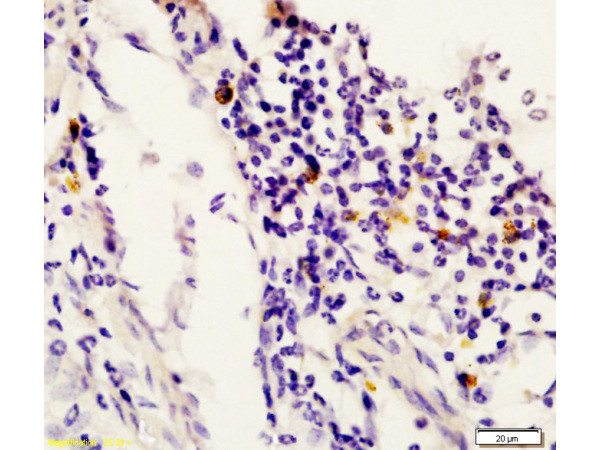 STAT6 Antibody in Immunohistochemistry (Paraffin) (IHC (P))
