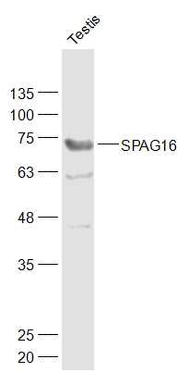SPAG16 Antibody in Western Blot (WB)