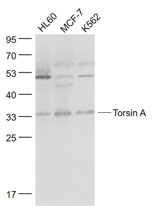 Torsin A Antibody in Western Blot (WB)
