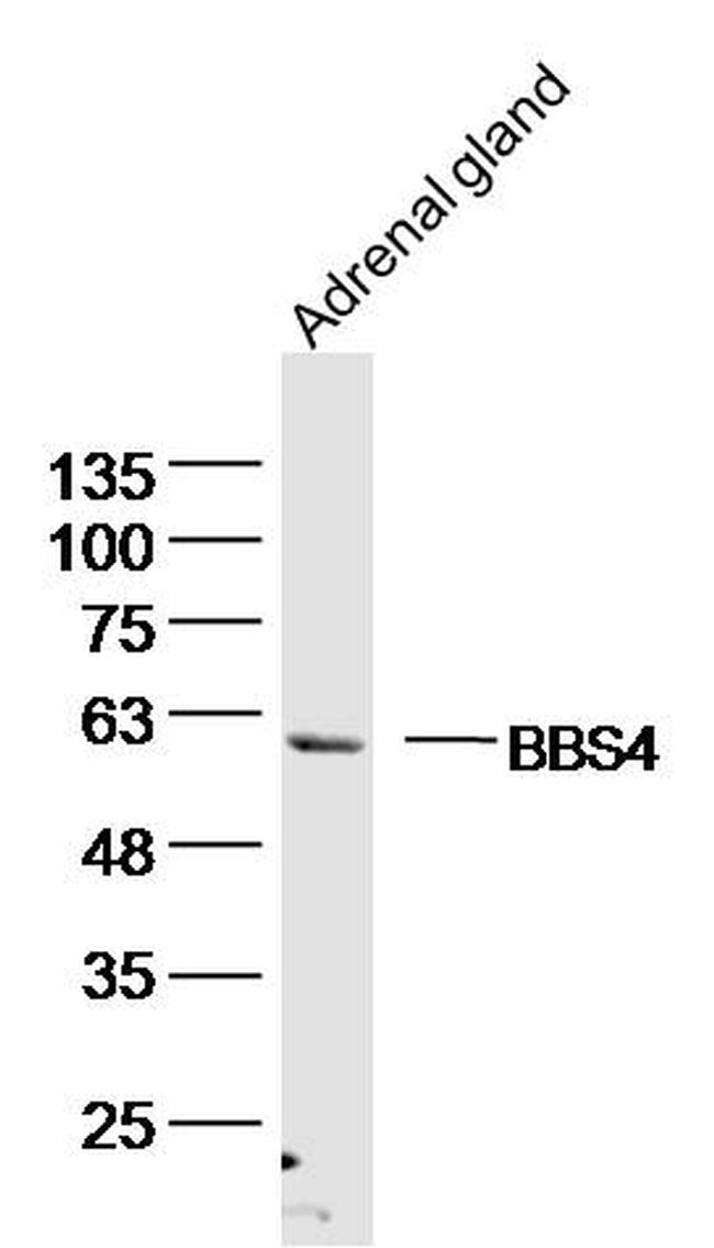 BBS4 Antibody in Western Blot (WB)