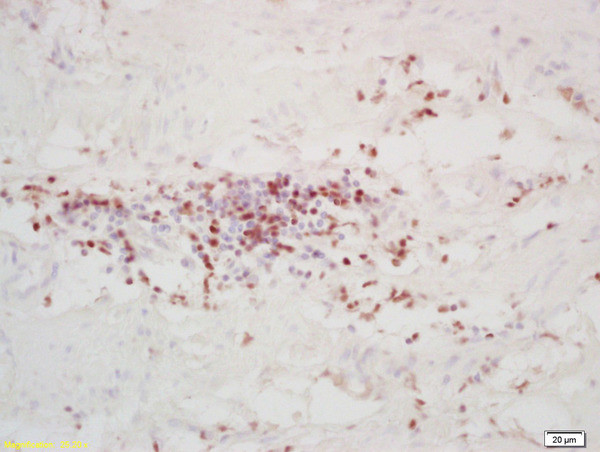 FOXD3 Antibody in Immunohistochemistry (Paraffin) (IHC (P))
