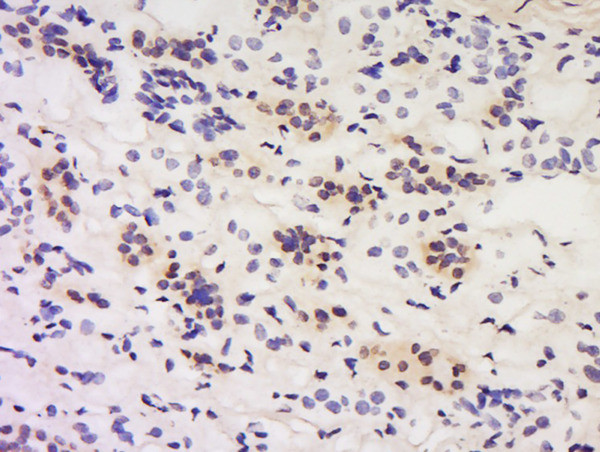 Calcipressin 1/DSCR 1 Antibody in Immunohistochemistry (Paraffin) (IHC (P))
