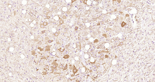 Calcipressin 3 Antibody in Immunohistochemistry (Paraffin) (IHC (P))
