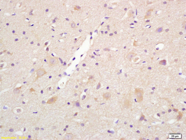 Centaurin alpha 1 Antibody in Immunohistochemistry (Paraffin) (IHC (P))