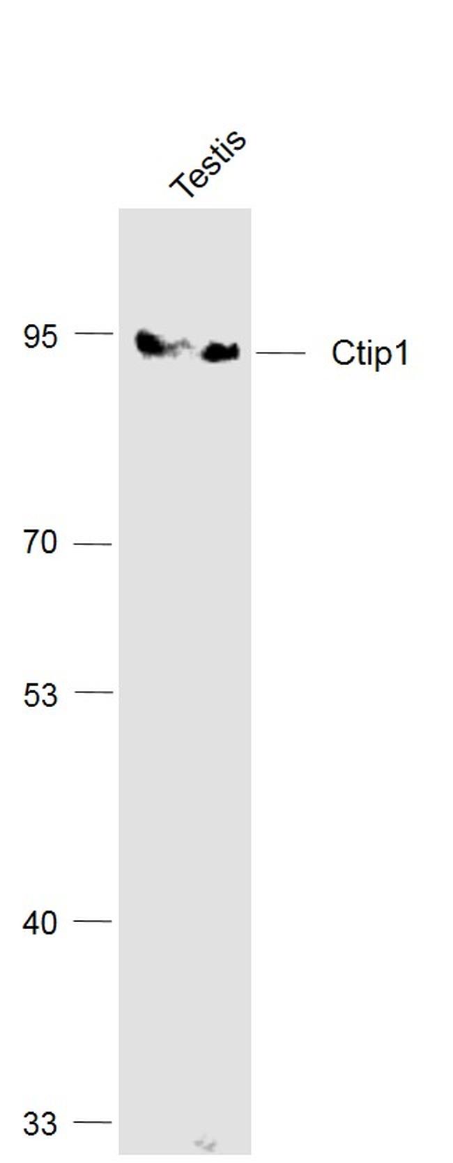 Ctip1/BCL-11A Antibody in Western Blot (WB)