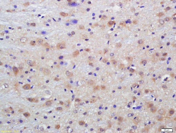 Phospho-Dab1 (Tyr198) Antibody in Immunohistochemistry (Paraffin) (IHC (P))