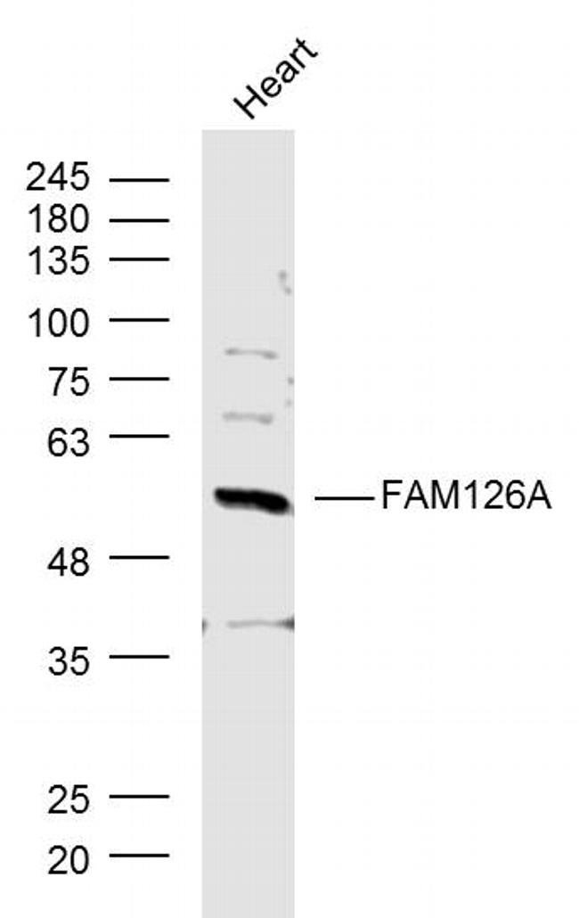 FAM126A/Hyccin Antibody in Western Blot (WB)