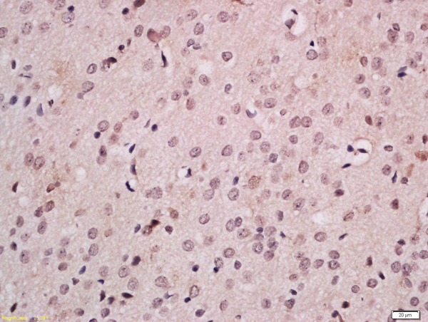 FOXB1 Antibody in Immunohistochemistry (Paraffin) (IHC (P))