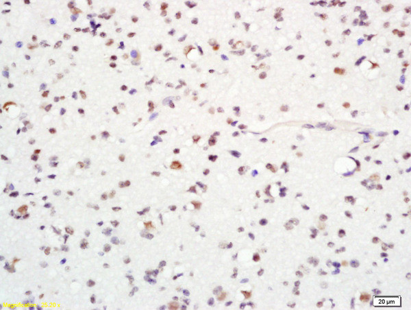 ASCL1 Antibody in Immunohistochemistry (Paraffin) (IHC (P))