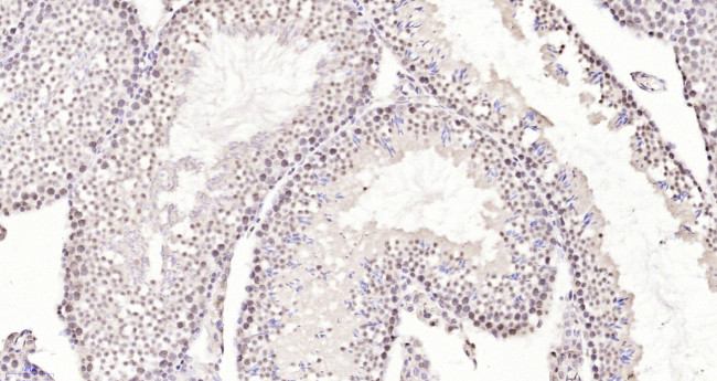 Neuro D4/DPF1 Antibody in Immunohistochemistry (Paraffin) (IHC (P))