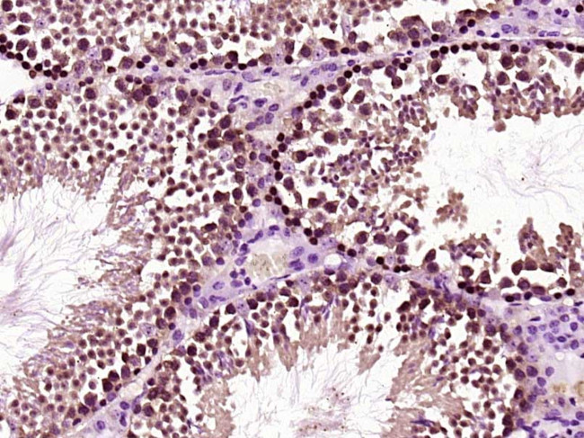 HOXC5 Antibody in Immunohistochemistry (Paraffin) (IHC (P))