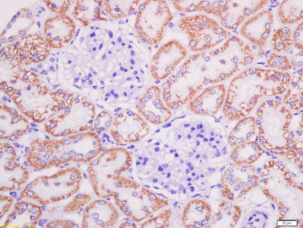 AGEs Antibody in Immunohistochemistry (Paraffin) (IHC (P))