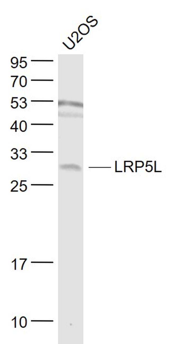 LRP5L Antibody in Western Blot (WB)