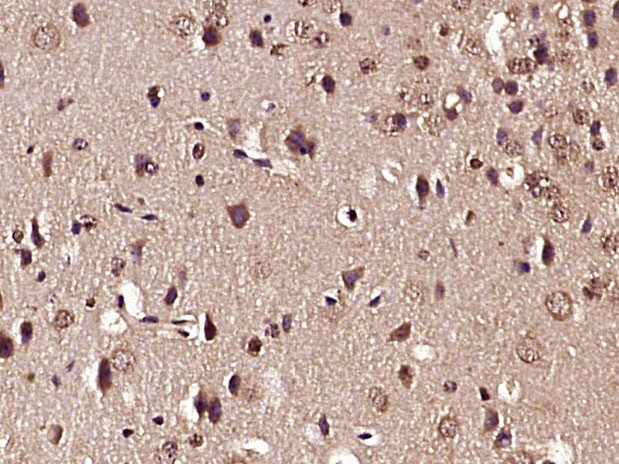 Phospho-GluR1 (Ser863) Antibody in Immunohistochemistry (Paraffin) (IHC (P))