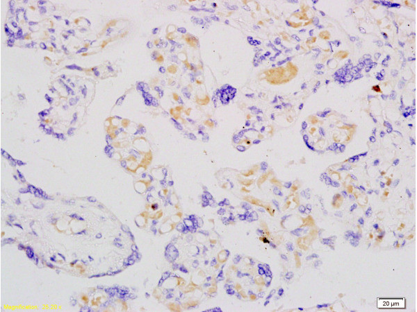 ADFP Antibody in Immunohistochemistry (Paraffin) (IHC (P))