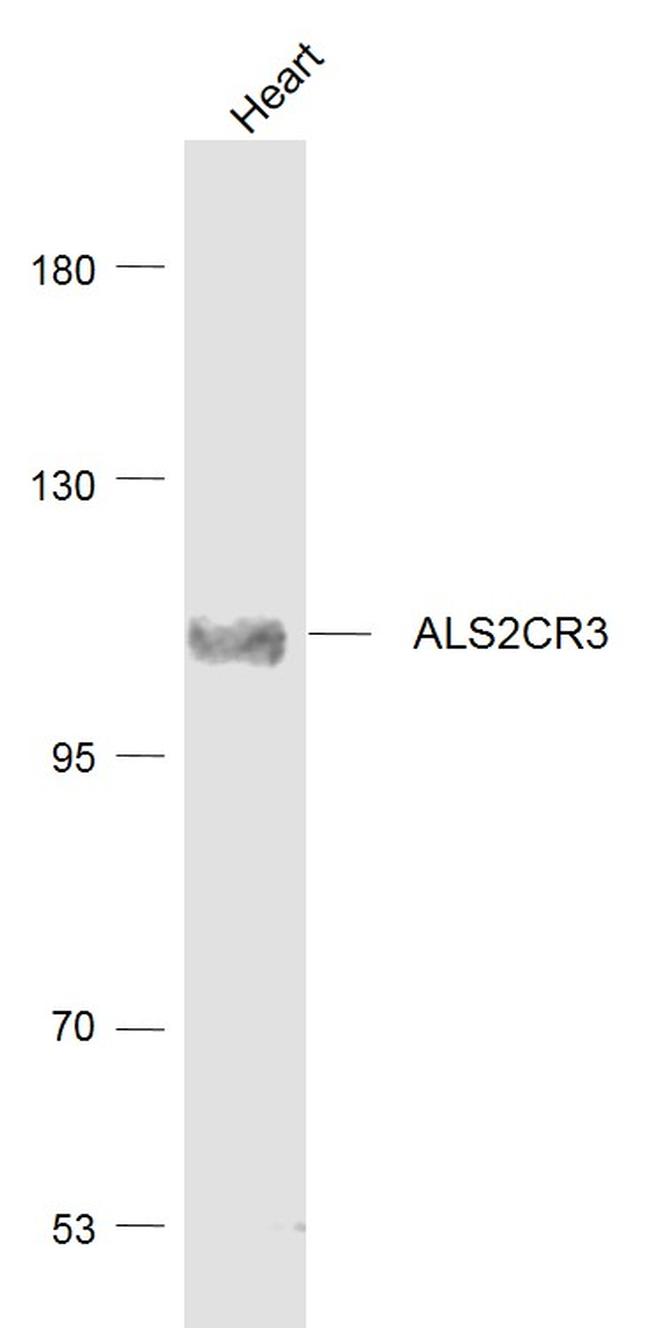 ALS2CR3 Antibody in Western Blot (WB)