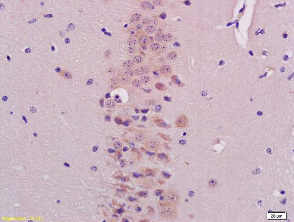 BHLHB9/p60TRP Antibody in Immunohistochemistry (Paraffin) (IHC (P))