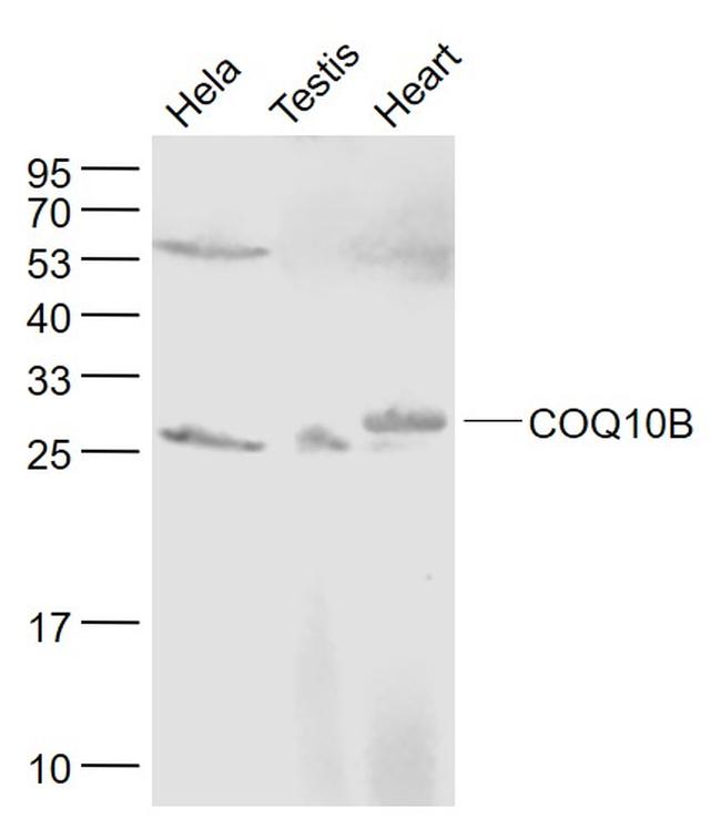 COQ10B Antibody in Western Blot (WB)