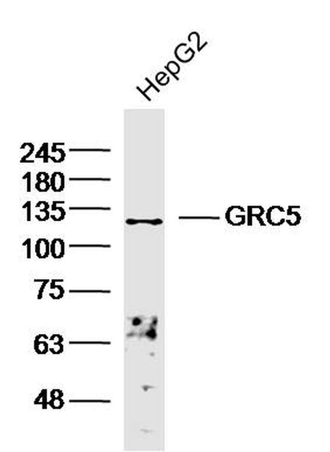 GRC5/PHF2 Antibody in Western Blot (WB)