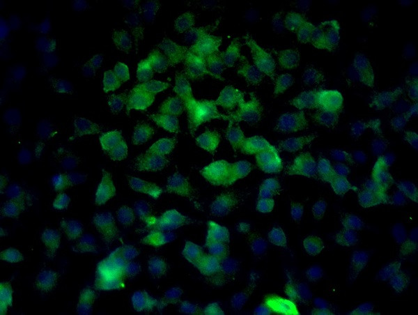 Beta catenin Antibody in Immunocytochemistry (ICC/IF)