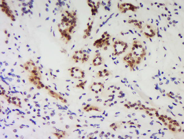 PNUTS/PPP1R10 Antibody in Immunohistochemistry (Paraffin) (IHC (P))