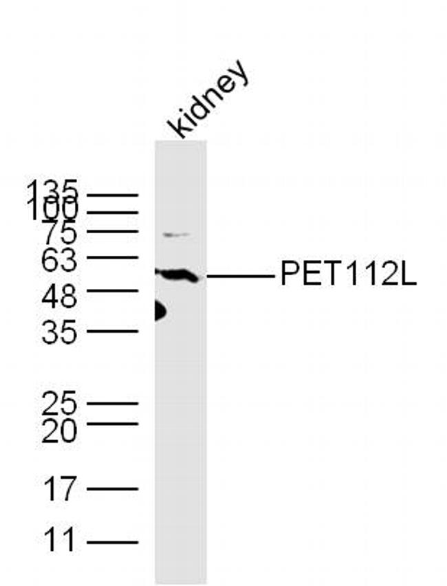 PET112L Antibody in Western Blot (WB)