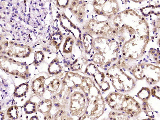 UBXD2 Antibody in Immunohistochemistry (Paraffin) (IHC (P))
