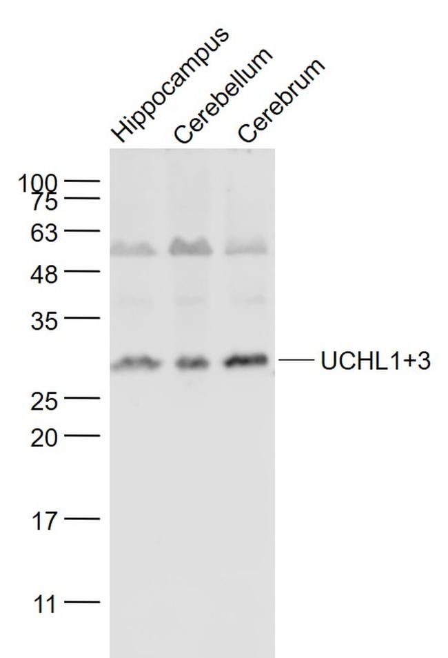 UCHL1+3 Antibody in Western Blot (WB)