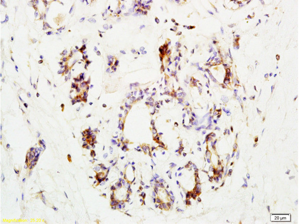 CCR3 Antibody in Immunohistochemistry (Paraffin) (IHC (P))