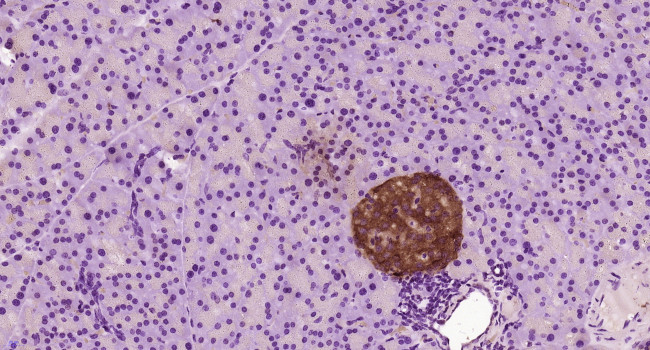 HYPE/HIP13 Antibody in Immunohistochemistry (Paraffin) (IHC (P))