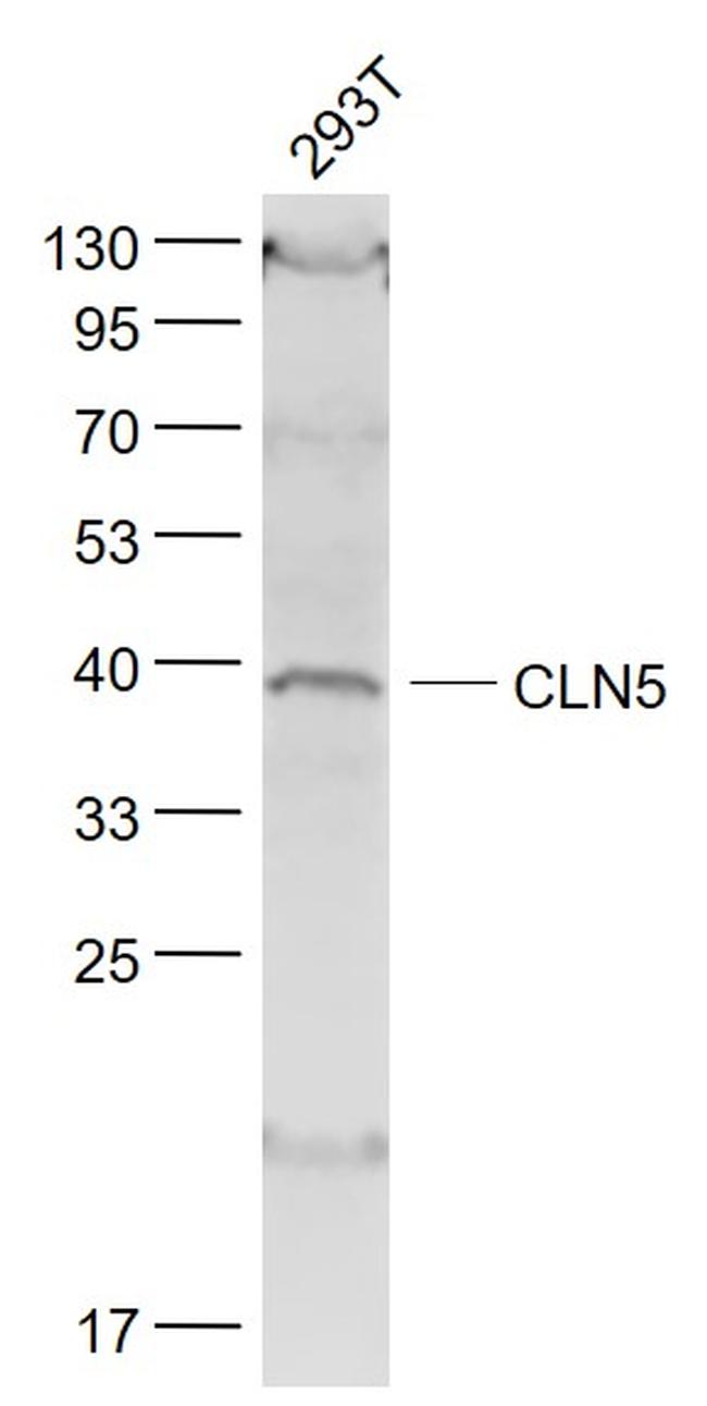 CLN5 Antibody in Western Blot (WB)