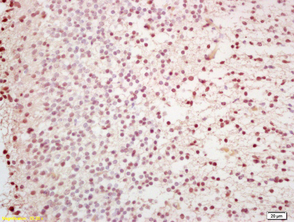 Capicua/CIC Antibody in Immunohistochemistry (Paraffin) (IHC (P))