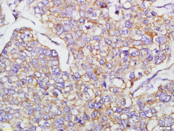 N-cadherin Antibody in Immunohistochemistry (Paraffin) (IHC (P))