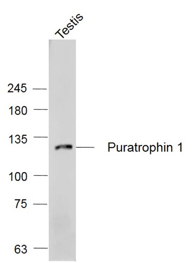 Puratrophin 1/PLEKHG4 Antibody in Western Blot (WB)