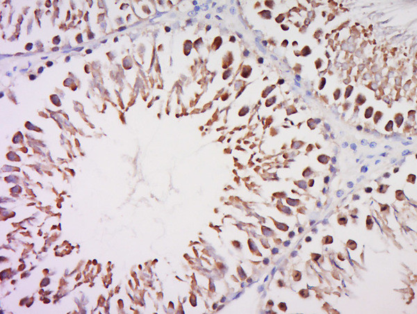 TFIID/TATA binding protein TBP Antibody in Immunohistochemistry (Paraffin) (IHC (P))