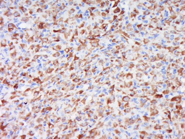 WRB/CHD5 Antibody in Immunohistochemistry (Paraffin) (IHC (P))