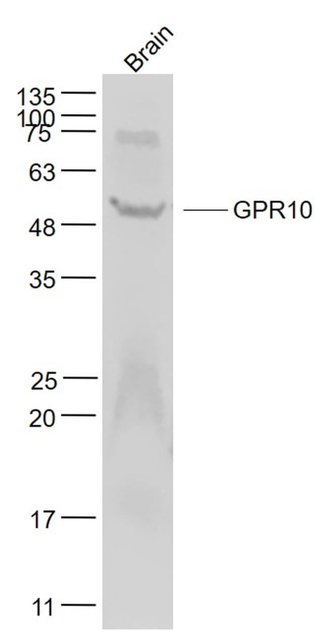 GPR10 Antibody in Western Blot (WB)