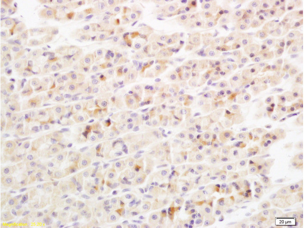 IL-17 Antibody in Immunohistochemistry (Paraffin) (IHC (P))