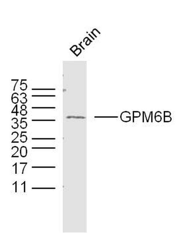 GPM6B Antibody in Western Blot (WB)
