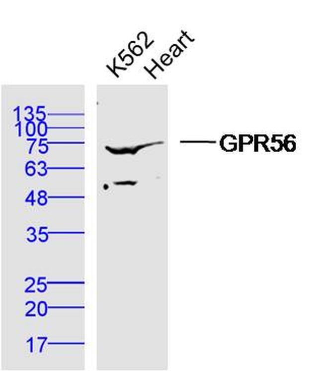 GPR56 Antibody in Western Blot (WB)