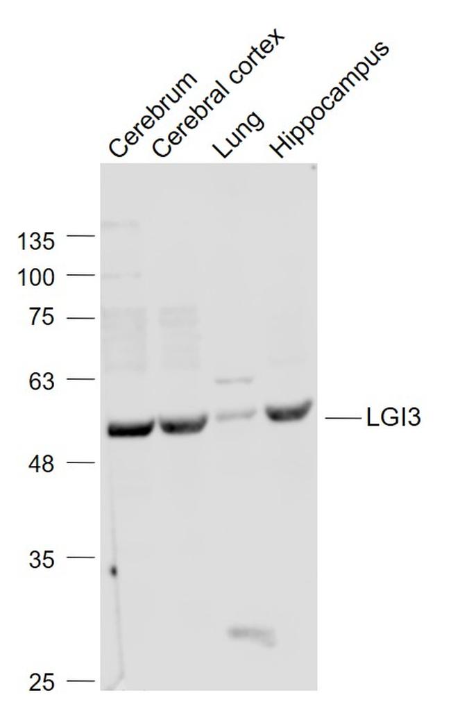 LGI3 Antibody in Western Blot (WB)