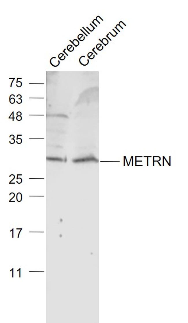 METRN Antibody in Western Blot (WB)