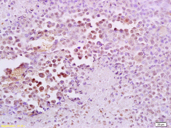 FRA2 Antibody in Immunohistochemistry (Paraffin) (IHC (P))