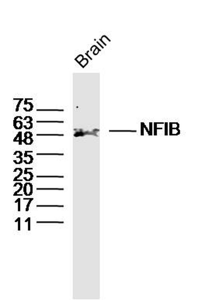 NFIB/NF1B2 Antibody in Western Blot (WB)