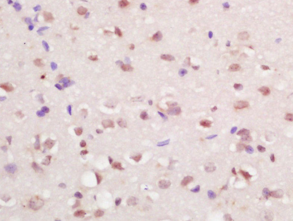 RFX4 Antibody in Immunohistochemistry (Paraffin) (IHC (P))
