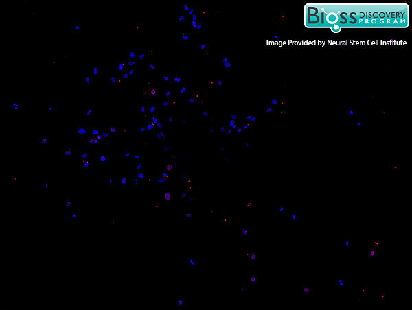 SATB2 Antibody in Immunocytochemistry (ICC/IF)