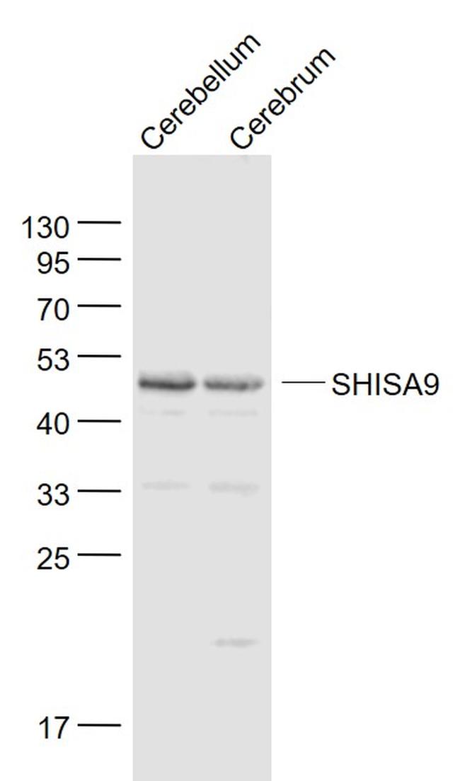 SHISA9 Antibody in Western Blot (WB)