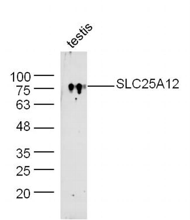 SLC25A12/ARALAR Antibody in Western Blot (WB)
