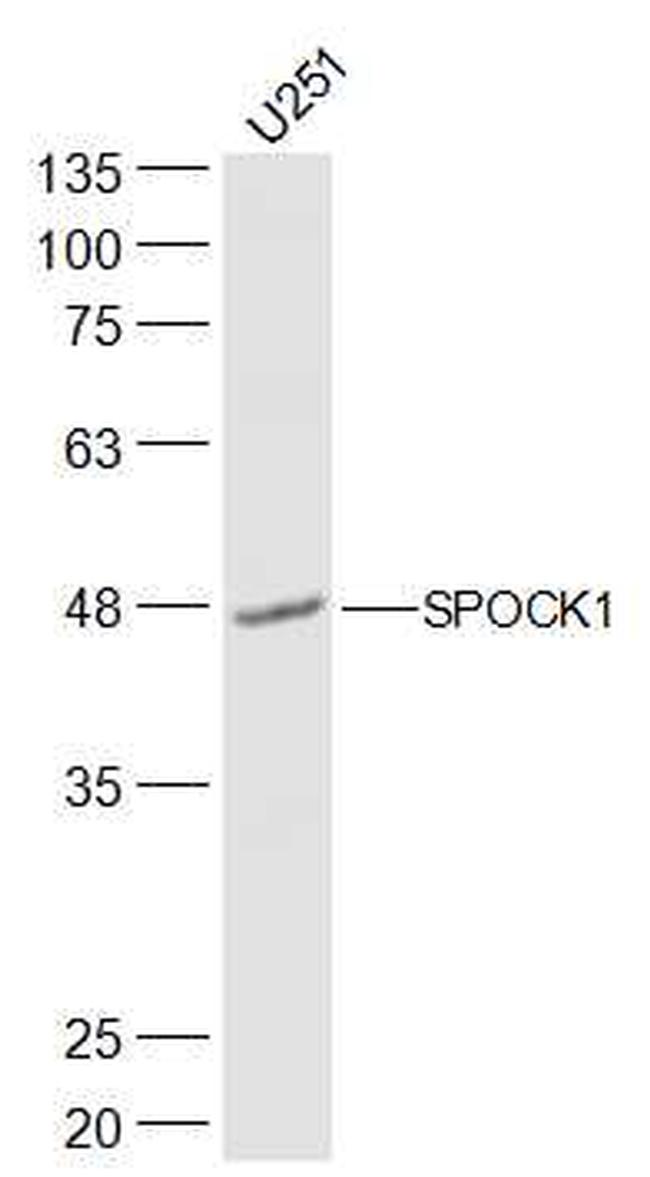 SPOCK1/Testican 1 Antibody in Western Blot (WB)